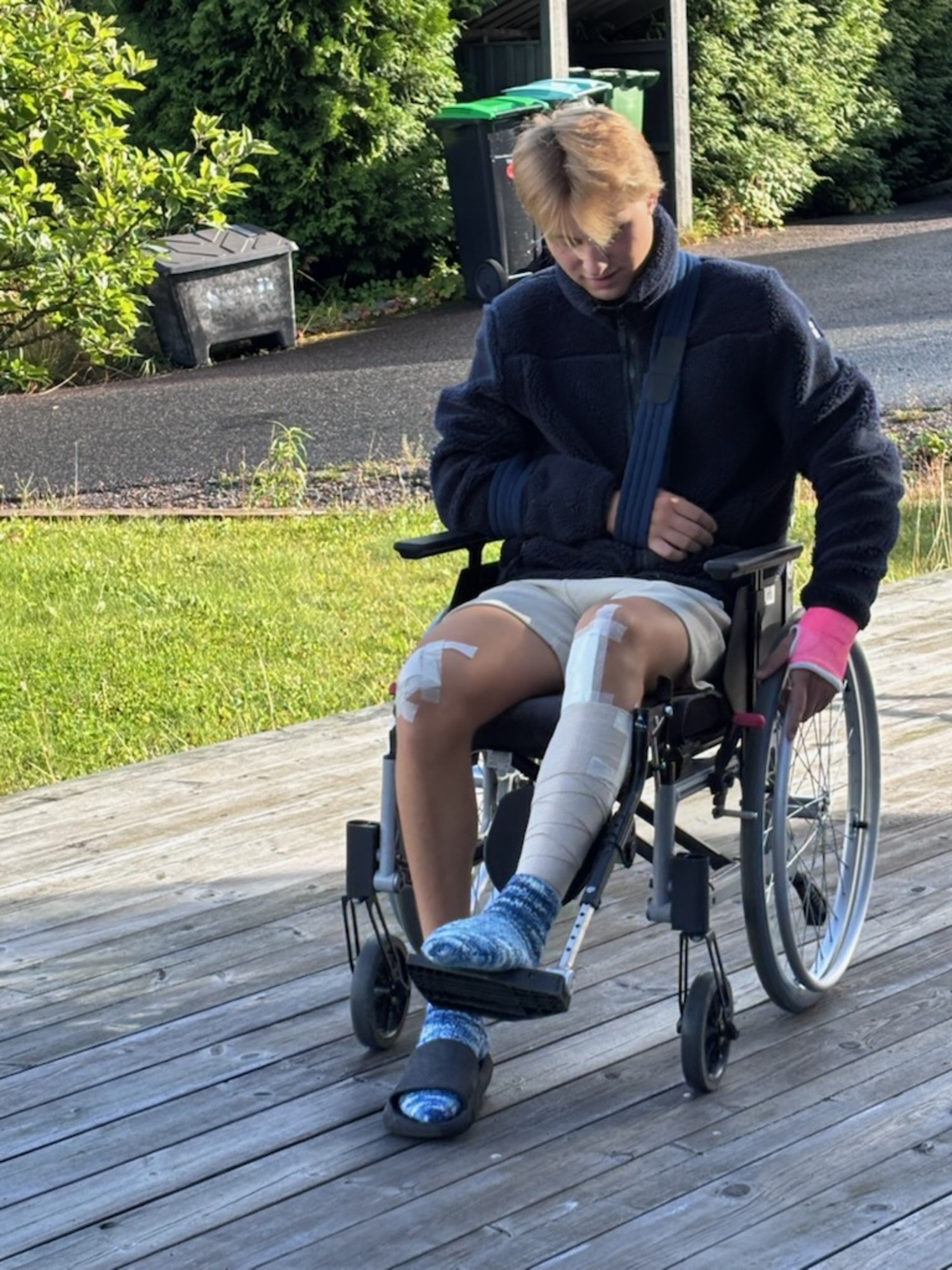 Gutt med bandasjert bein og gipsa hånd i rullestol
